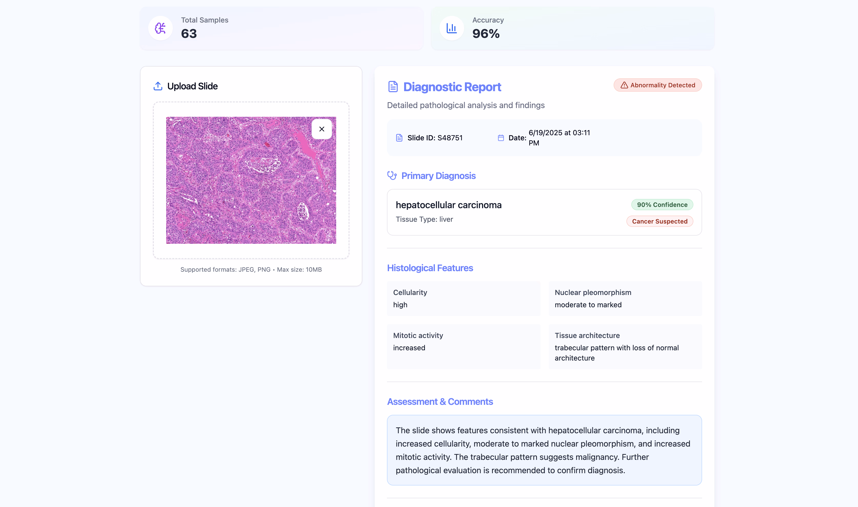 Healthcare & Life Sciences use case: Clinical Notes Entity Extraction for Diagnostics showing text annotation workflow